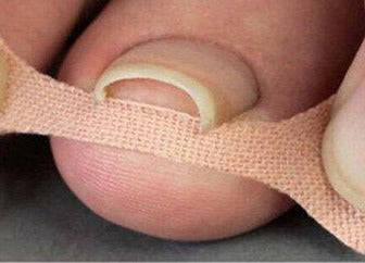 Nail Pain Relief Bandage