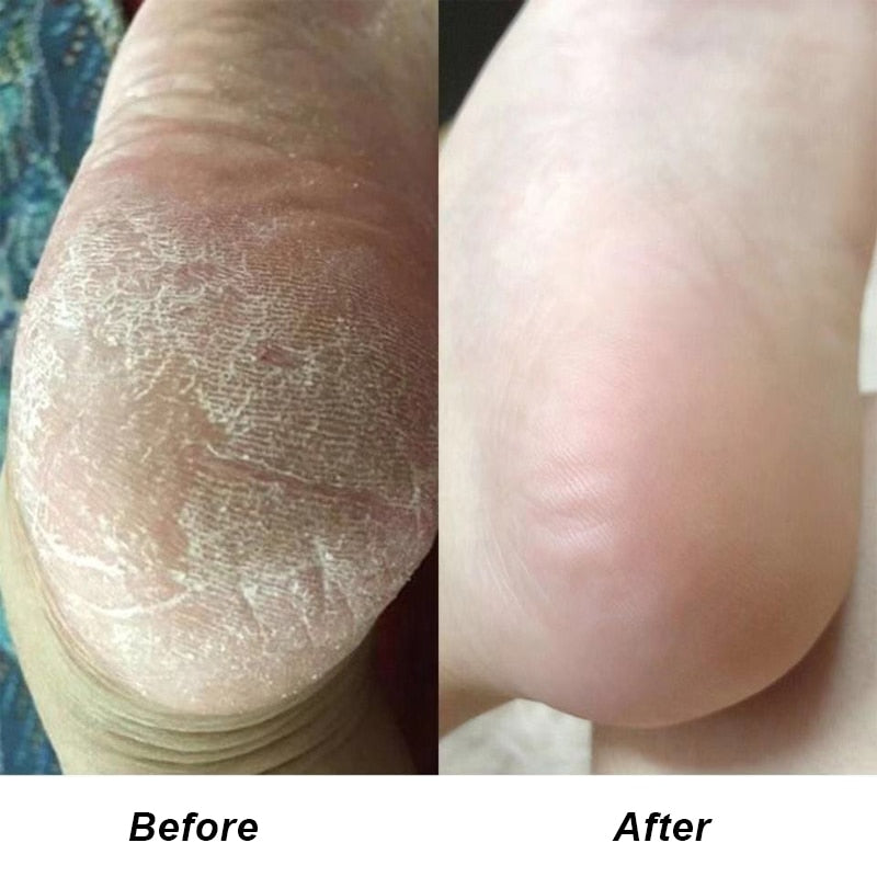 Exfoliating Pedicure Spray